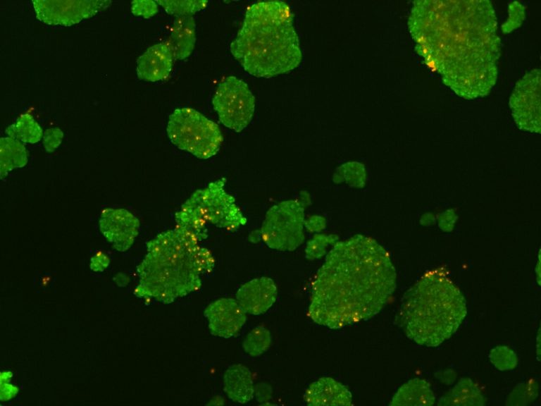 شیکاریی(Islet cell antibody) NAW LAB